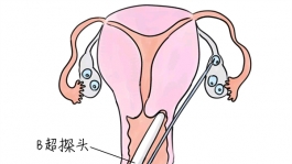 幼儿学画画，青岛捐卵宝宝学画画，学画画的好处，如何学画画