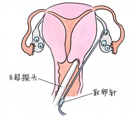 幼儿学画画，青岛捐卵宝宝学画画，学画画的好处，如何学画画