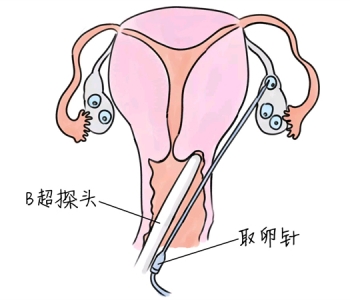 幼儿学画画，青岛捐卵宝宝学画画，学画画的好处，如何学画画